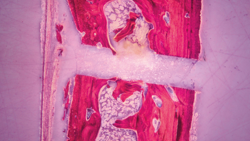 histological picture of a bone cut with PIEZOSURGERY®